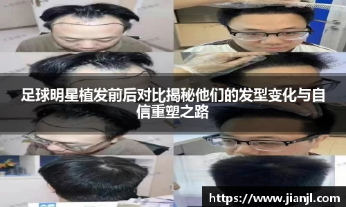 足球明星植发前后对比揭秘他们的发型变化与自信重塑之路
